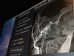 Case 1 from Bicetre Hospital in France