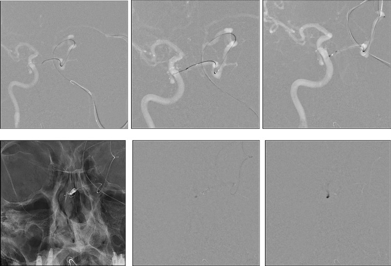 figure15