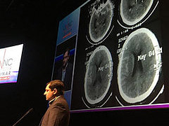 LINNC ASIA 2019 - Second attendee case