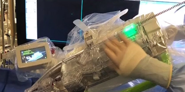 First transradial robotic carotid stenting in the US