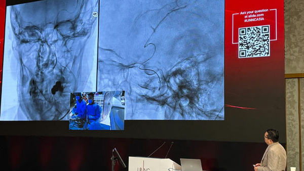 Day 2 at LINNC Asia 2025 in Da Nang: flow diversion, giant aneurysms and advanced imaging