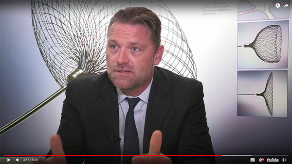 Cerus Endovascular: what the future holds here