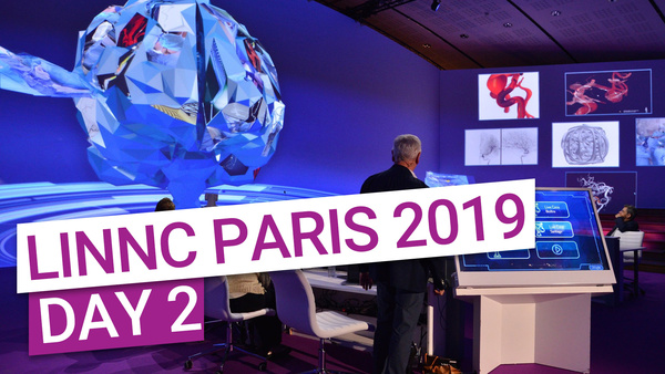 How do experts from China or Chile treat aneurysms? Live from around the world at LINNC Paris 2019!