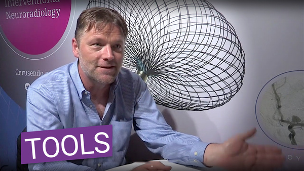 Providing the tools for the interventional neuroradiologist – Cerus Endovascular