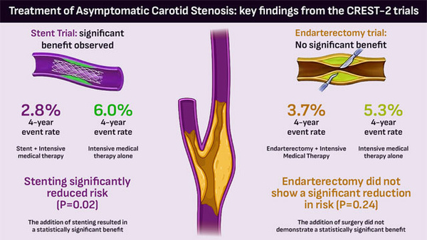 CREST-2: Carotid Artery Stenting for Primary Stroke Prevention