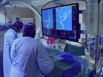 Robotic treatment of an Acom aneurysm