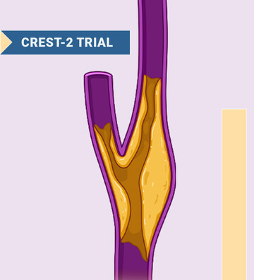 CREST-2: Carotid Artery Stenting for Primary Stroke Prevention