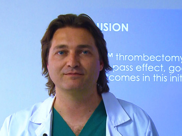 Initial Clinical Experience with the NeVa thrombectomy device