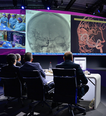 LINNC Paris 2026, Day 1: Hemorrhagic stroke, expanding boundaries, and the judgment to know the difference