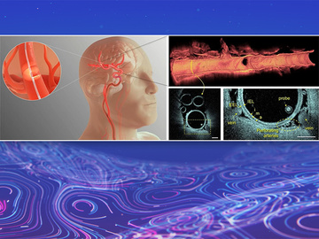 Intravascular Imaging in Neuro: Is dedicated OCT a revolution?
