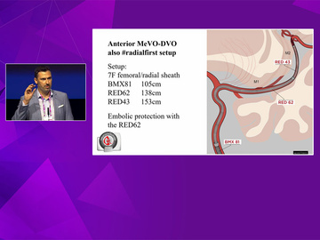 Penumbra symposium - The power of dedicated technologies for distal occlusions