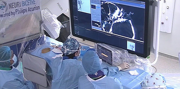 Percutaneous embolization of a lymphatic sac tumor after direct puncture
