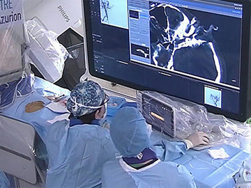 Percutaneous embolization of a lymphatic sac tumor after direct puncture