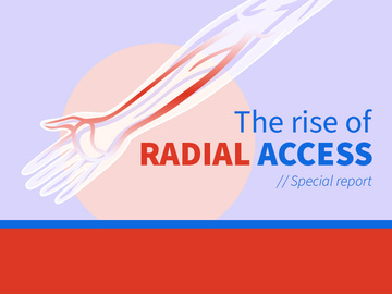 Radial access: an INR breakthrough?