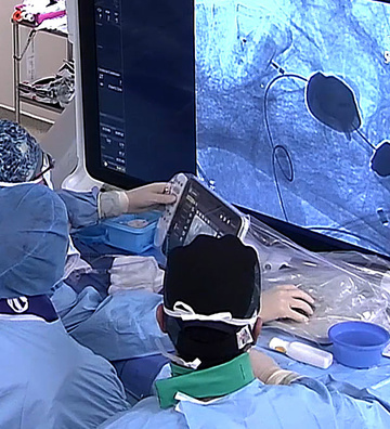 Right MCA bifurcation aneurysm treated with balloon-assisted intrasaccular flow disruptor