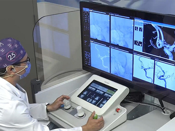 Robotic treatment of an Acom aneurysm