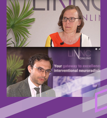 Sharing the learnings from early clinical experience of Surpass Elite Flow Diverter