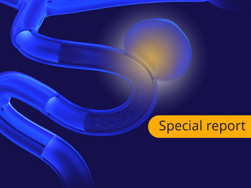 Step into the future of flow diverters with our latest special report!