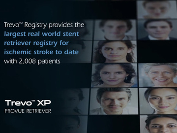 Trevo Registry provides the largest real world stent retriever registry for ischemic stroke to date with 2,008 patients