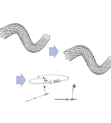The role of MicroNet ™- Covered Carotid Stents in the Post-CREST-2 World