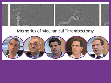 Therapies stories - Memories of Mechanical Thrombectomy