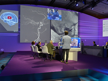 Treating stroke – sharing clinical experience: Day 3 at LINNC Paris 2019 