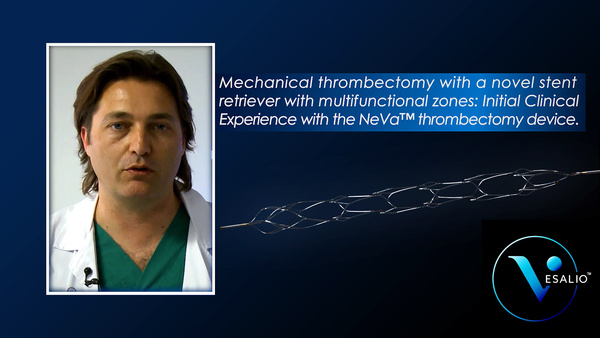 Initial Clinical Experience with the NeVa thrombectomy device