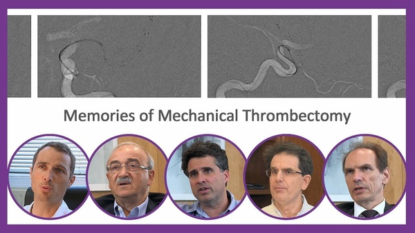Therapies stories - Memories of Mechanical Thrombectomy
