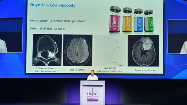 Onyx™ 12 at LINNC Paris 2026