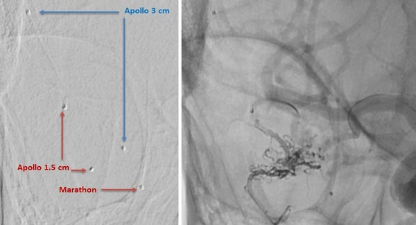 arterial-access