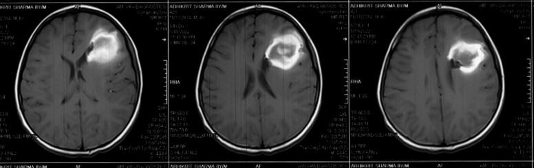case2