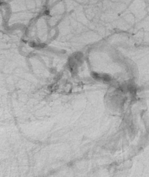 venous-drainage