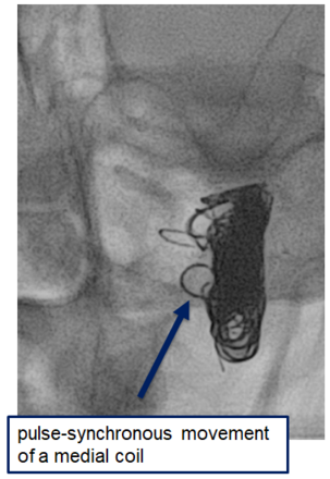 xray