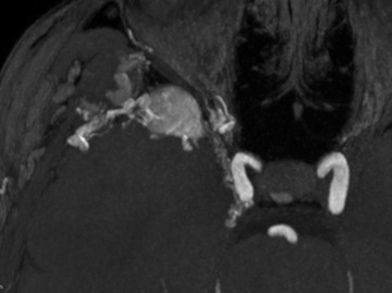 Figure 2 - So close yet so far