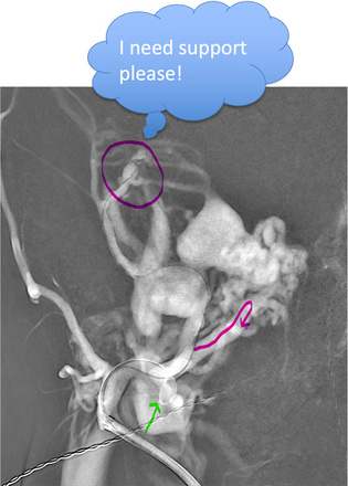 Figure 5 - So close yet so far