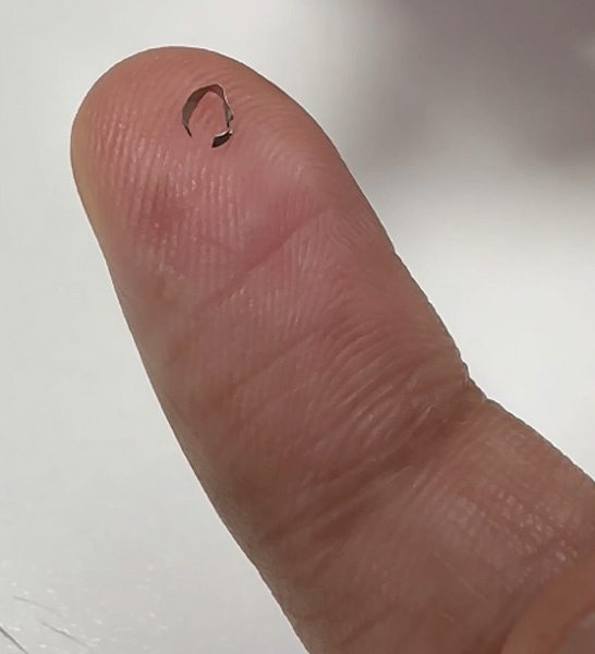 Figure 9 - Solumbra for foreign body retrieval