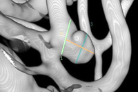 Visualizing the Impact of the WEB - clinical cases
