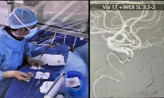 LINNC Asia 20025 - Day 1