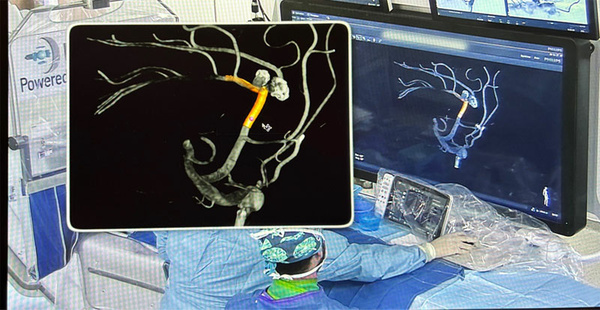 LINNC Asia 20025 - Day 1