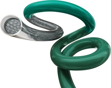 Terumo Neuro’s SOFIA™ Catheter Line is Backed By 10 Years of Proven Clinical Performance and Innovation – The New SOFIA™ 88 Catheter Offers Reliable Trackability, Proximal Stability and Vessel-Friendly Flexibility