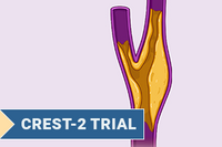 CREST-2 Trial