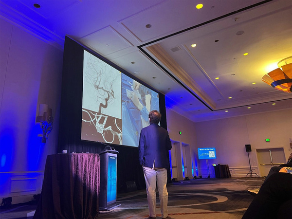 Day 1 at LINNC Americas 2026: Live from Orlando – From wide-neck aneurysms and complex AVMs to emergency neurovascular rescue