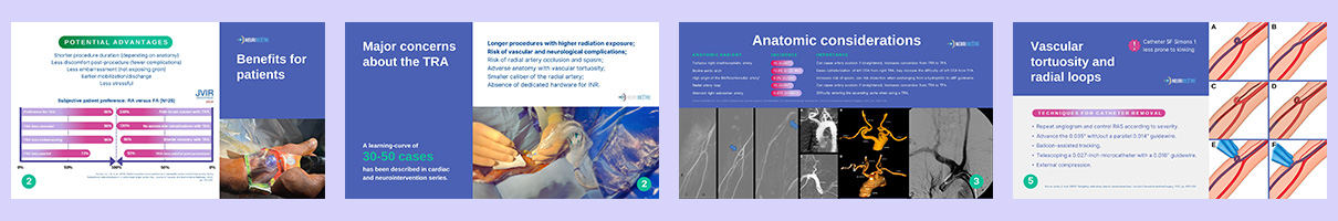 A complete overview of radial access