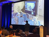 Aneurysms, AVMs and more at LINNC Americas 2023