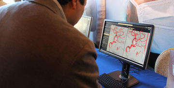 LINNC Americas - 3D Aneurysm