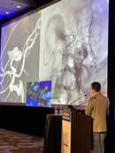 Stroke and ischemic disease at LINNC Americas 2023