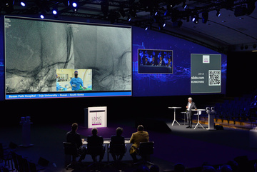 first live case of aneurysm treatment from South Korea