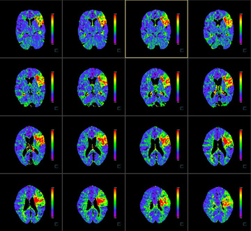 Time to peak maps from initial CTP
