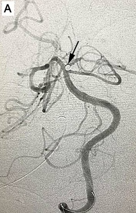 Angiography 1