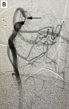 Angiography 2
